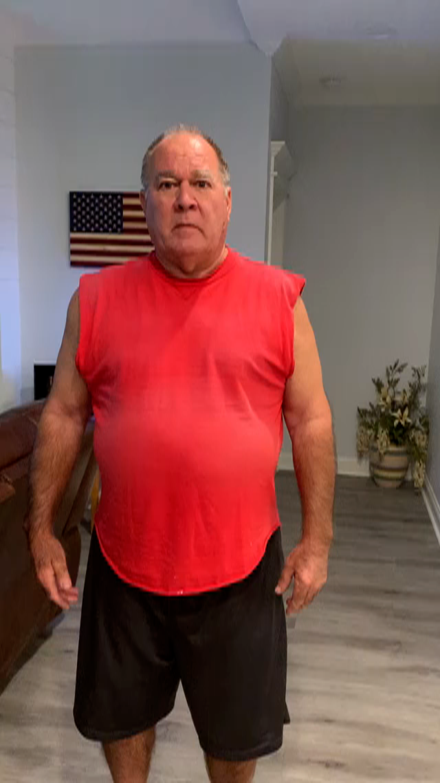 Picture of David after recovering without surgery using the ERMI Flexionater